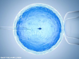 无精症